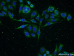 GADD34 Rabbit anti-Human, Mouse, Rat, Polyclonal, Proteintech 150 &mu;L;