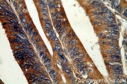 GADD34 Rabbit anti-Human, Mouse, Rat, Polyclonal, Proteintech 150 &mu;L;