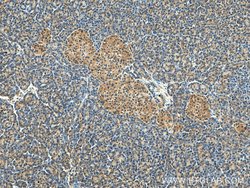 GADD34 Rabbit anti-Human, Mouse, Rat, Polyclonal, Proteintech 150 &mu;L;