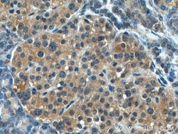 GADD34 Rabbit anti-Human, Mouse, Rat, Polyclonal, Proteintech 150 &mu;L;