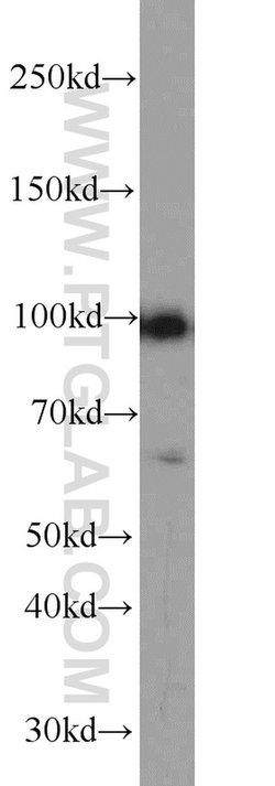 GADD34 Rabbit anti-Human, Mouse, Rat, Polyclonal, Proteintech 150 &mu;L;
