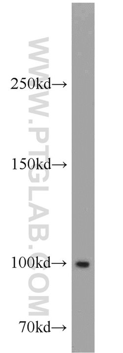 GADD34 Rabbit anti-Human, Mouse, Rat, Polyclonal, Proteintech 150 &mu;L;