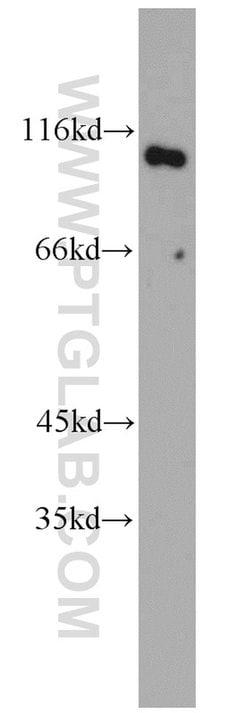 GADD34 Rabbit anti-Human, Mouse, Rat, Polyclonal, Proteintech 150 &mu;L;