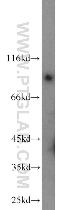 GADD34 Rabbit anti-Human, Mouse, Rat, Polyclonal, Proteintech 150 &mu;L;