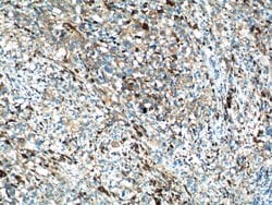 SLC45A2 Rabbit anti-Human, Mouse, Rat, Polyclonal, Proteintech 150 &mu;L;