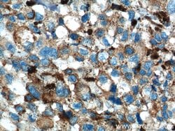 SLC45A2 Rabbit anti-Human, Mouse, Rat, Polyclonal, Proteintech 150 &mu;L;