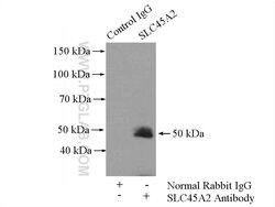SLC45A2 Rabbit anti-Human, Mouse, Rat, Polyclonal, Proteintech 150 &mu;L;