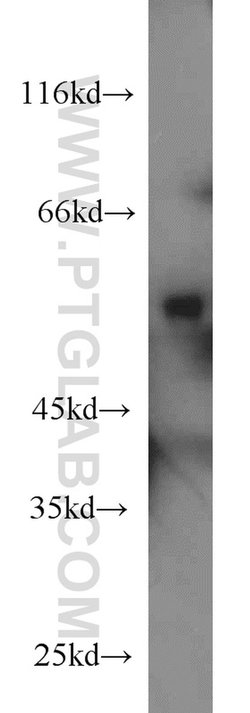 SLC45A2 Rabbit anti-Human, Mouse, Rat, Polyclonal, Proteintech 150 &mu;L;