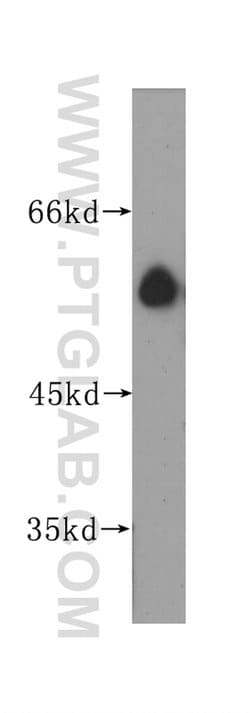 SLC45A2 Rabbit anti-Human, Mouse, Rat, Polyclonal, Proteintech 150 &mu;L;