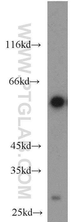 SLC45A2 Rabbit anti-Human, Mouse, Rat, Polyclonal, Proteintech 150 &mu;L;
