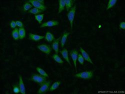 CLTB Rabbit anti-Human, Mouse, Rat, Polyclonal, Proteintech:Antibodies:Primary