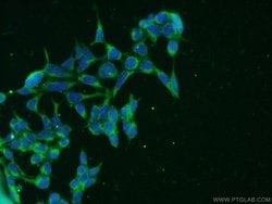 CLTB Rabbit anti-Human, Mouse, Rat, Polyclonal, Proteintech:Antibodies:Primary