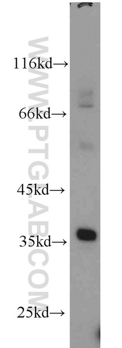 CLTB Rabbit anti-Human, Mouse, Rat, Polyclonal, Proteintech:Antibodies:Primary