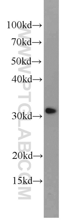 CLTB Rabbit anti-Human, Mouse, Rat, Polyclonal, Proteintech:Antibodies:Primary