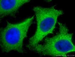 CLTB Rabbit anti-Human, Mouse, Rat, Polyclonal, Proteintech:Antibodies:Primary