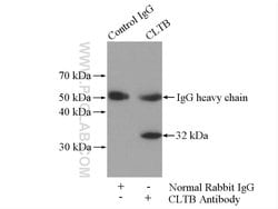 CLTB Rabbit anti-Human, Mouse, Rat, Polyclonal, Proteintech:Antibodies:Primary