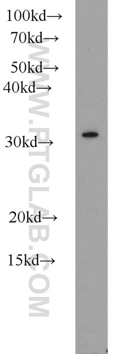 CLTB Rabbit anti-Human, Mouse, Rat, Polyclonal, Proteintech:Antibodies:Primary