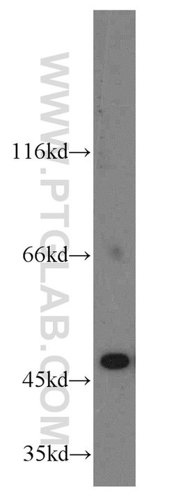 EIF4A3 Rabbit anti-Human, Mouse, Polyclonal, Proteintech 150 &mu;L; Unconjugated 