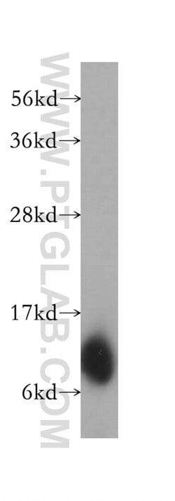 LAMA4 (Isoform 3) Rabbit anti-Human, Polyclonal, Proteintech 20 &mu;L;