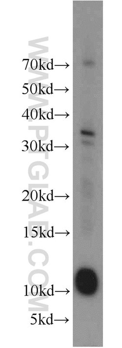 LAMA4 (Isoform 3) Rabbit anti-Human, Polyclonal, Proteintech 20 &mu;L;