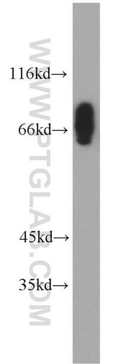CLINT1 Rabbit anti-Human, Mouse, Rat, Polyclonal, Proteintech 150 &mu;L;