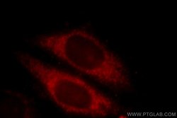 CLINT1 Rabbit anti-Human, Mouse, Rat, Polyclonal, Proteintech 150 &mu;L;