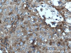 CLINT1 Rabbit anti-Human, Mouse, Rat, Polyclonal, Proteintech 150 &mu;L;
