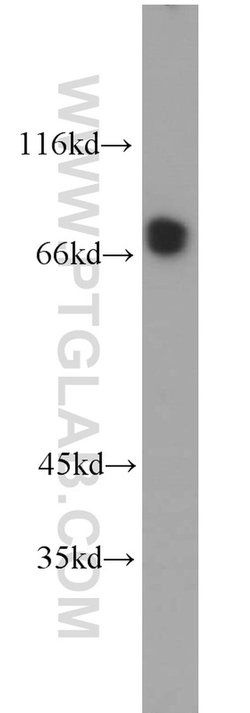 CLINT1 Rabbit anti-Human, Mouse, Rat, Polyclonal, Proteintech 150 &mu;L;