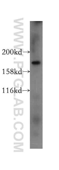 PTPN23 Rabbit anti-Human, Mouse, Rat, Polyclonal, Proteintech 150 &mu;L;