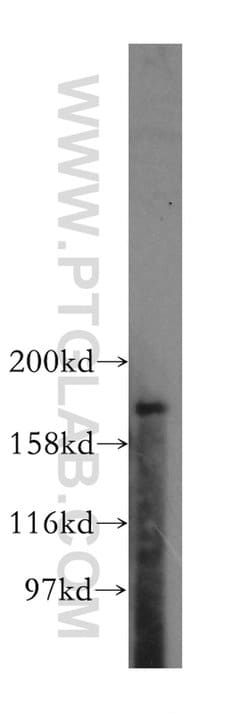 PTPN23 Rabbit anti-Human, Mouse, Rat, Polyclonal, Proteintech 150 &mu;L;
