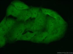 IRAK1 Rabbit anti-Human, Mouse, Rat, Polyclonal, Proteintech:Antibodies:Primary