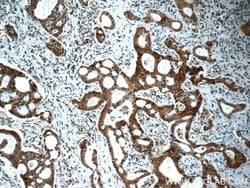 IRAK1 Rabbit anti-Human, Mouse, Rat, Polyclonal, Proteintech:Antibodies:Primary