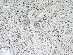 IRAK1 Rabbit anti-Human, Mouse, Rat, Polyclonal, Proteintech:Antibodies:Primary