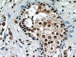 IRAK1 Rabbit anti-Human, Mouse, Rat, Polyclonal, Proteintech:Antibodies:Primary