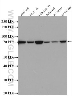 IRAK1 Rabbit anti-Human, Mouse, Rat, Polyclonal, Proteintech:Antibodies:Primary