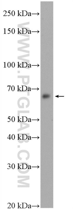 IRAK1 Rabbit anti-Human, Mouse, Rat, Polyclonal, Proteintech:Antibodies:Primary