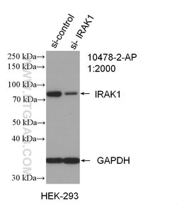 IRAK1 Rabbit anti-Human, Mouse, Rat, Polyclonal, Proteintech:Antibodies:Primary