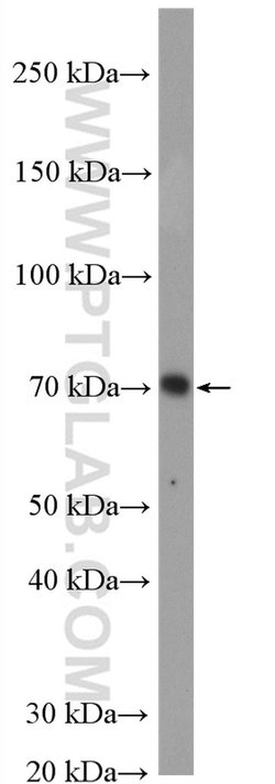 IRAK1 Rabbit anti-Human, Mouse, Rat, Polyclonal, Proteintech:Antibodies:Primary