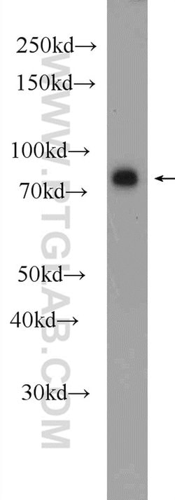 IRAK1 Rabbit anti-Human, Mouse, Rat, Polyclonal, Proteintech:Antibodies:Primary