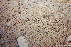 DOK4 Rabbit anti-Human, Mouse, Rat, Polyclonal, Proteintech 150 &mu;L;