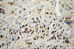 DOK4 Rabbit anti-Human, Mouse, Rat, Polyclonal, Proteintech 150 &mu;L;