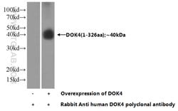 DOK4 Rabbit anti-Human, Mouse, Rat, Polyclonal, Proteintech 150 &mu;L;