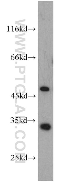 EEF1B2 Rabbit anti-Human, Mouse, Rat, Polyclonal, Proteintech 150 &mu;L;