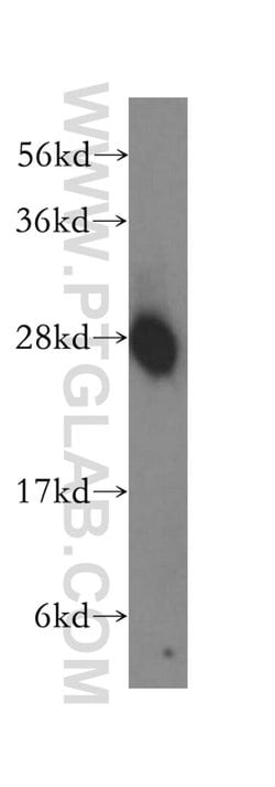 EEF1B2 Rabbit anti-Human, Mouse, Rat, Polyclonal, Proteintech 150 &mu;L;