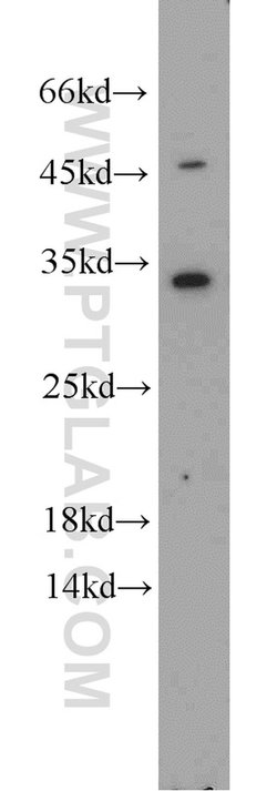 EEF1B2 Rabbit anti-Human, Mouse, Rat, Polyclonal, Proteintech 150 &mu;L;