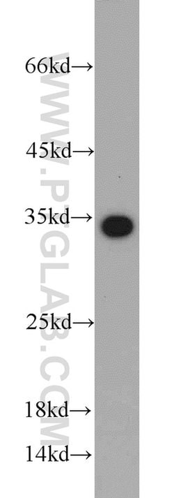 EEF1B2 Rabbit anti-Human, Mouse, Rat, Polyclonal, Proteintech 150 &mu;L;