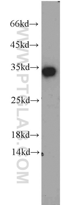 EEF1B2 Rabbit anti-Human, Mouse, Rat, Polyclonal, Proteintech 150 &mu;L;