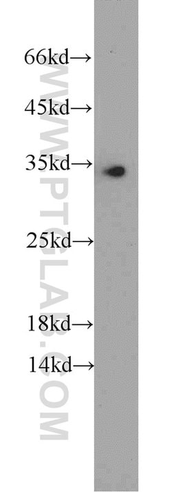 EEF1B2 Rabbit anti-Human, Mouse, Rat, Polyclonal, Proteintech 150 &mu;L;
