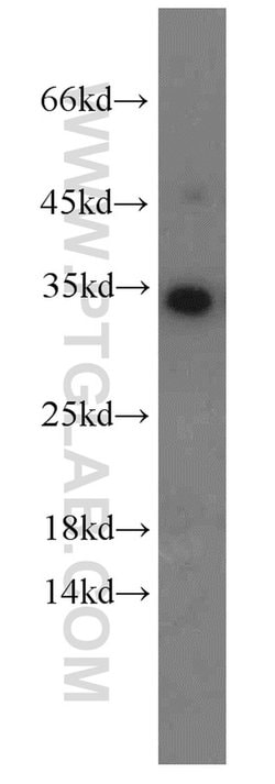 EEF1B2 Rabbit anti-Human, Mouse, Rat, Polyclonal, Proteintech 150 &mu;L;