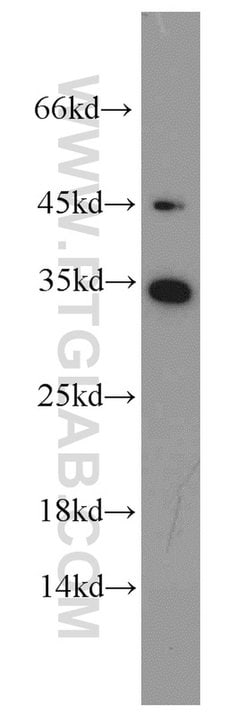 EEF1B2 Rabbit anti-Human, Mouse, Rat, Polyclonal, Proteintech 150 &mu;L;